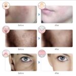 Rechargeable Facial LED Mask 7 Colors Photon Luminotherapy Beauty Mask Skin Rejuvenation Anti Acne Home Face Lifting and Whitening