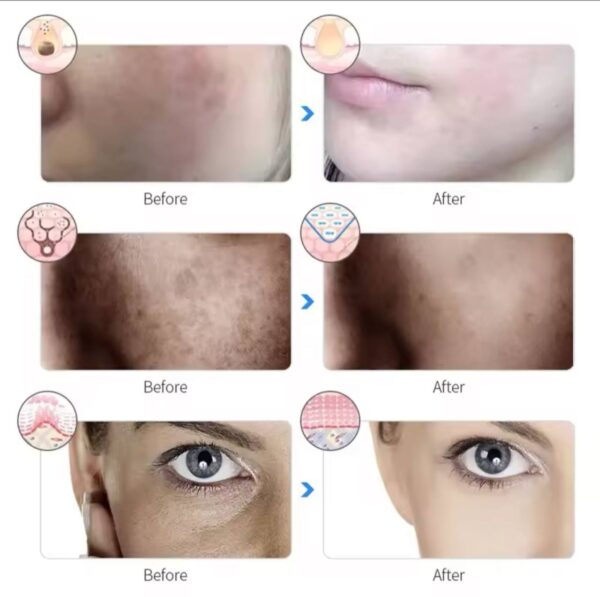 Rechargeable Facial LED Mask 7 Colors Photon Luminotherapy Beauty Mask Skin Rejuvenation Anti Acne Home Face Lifting and Whitening